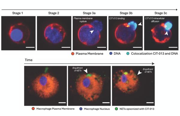 Citryll Secures €85M to Advance Monoclonal Antibody Targeting NETs in Inflammatory Diseases