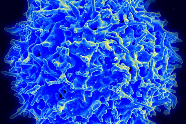 AbbVie Partners with Simcere on T-Cell Engager for Multiple Myeloma in $1B Deal